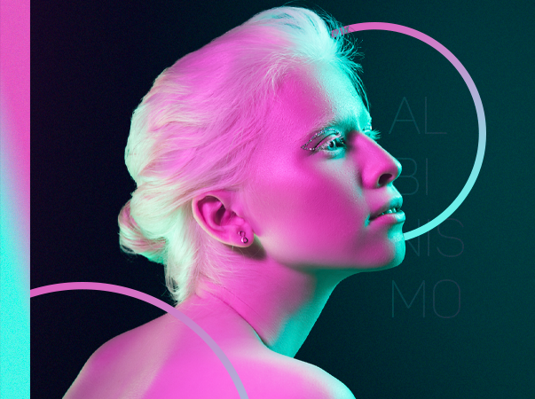 Data celebrada em 13 de junho conscientiza a população sobre o albinismo