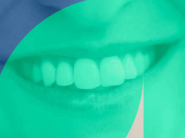 Curso de Odontologia da Unileão desenvolve projeto para beneficiar a APAE