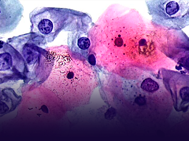 Unileão está com inscrições abertas para pós-graduação em Citologia Clínica