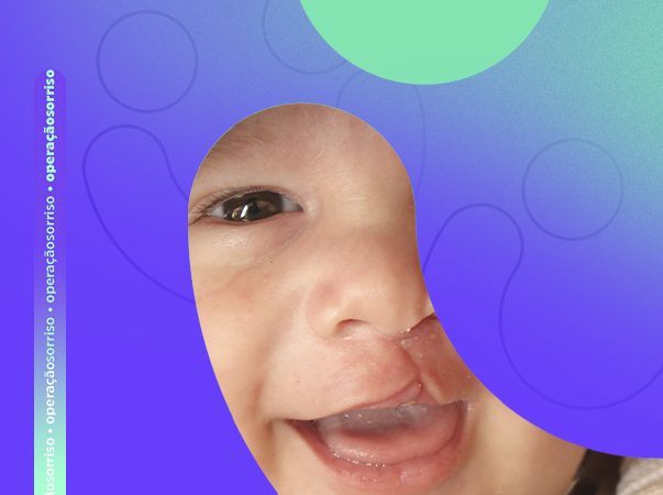 Unileão realiza ambulatório para cirurgias de fissuras faciais da Operação Sorriso